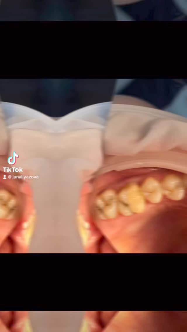 Работа Pro Stom