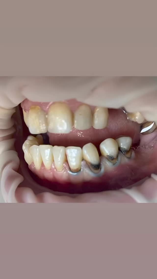 Работа Pro Stom