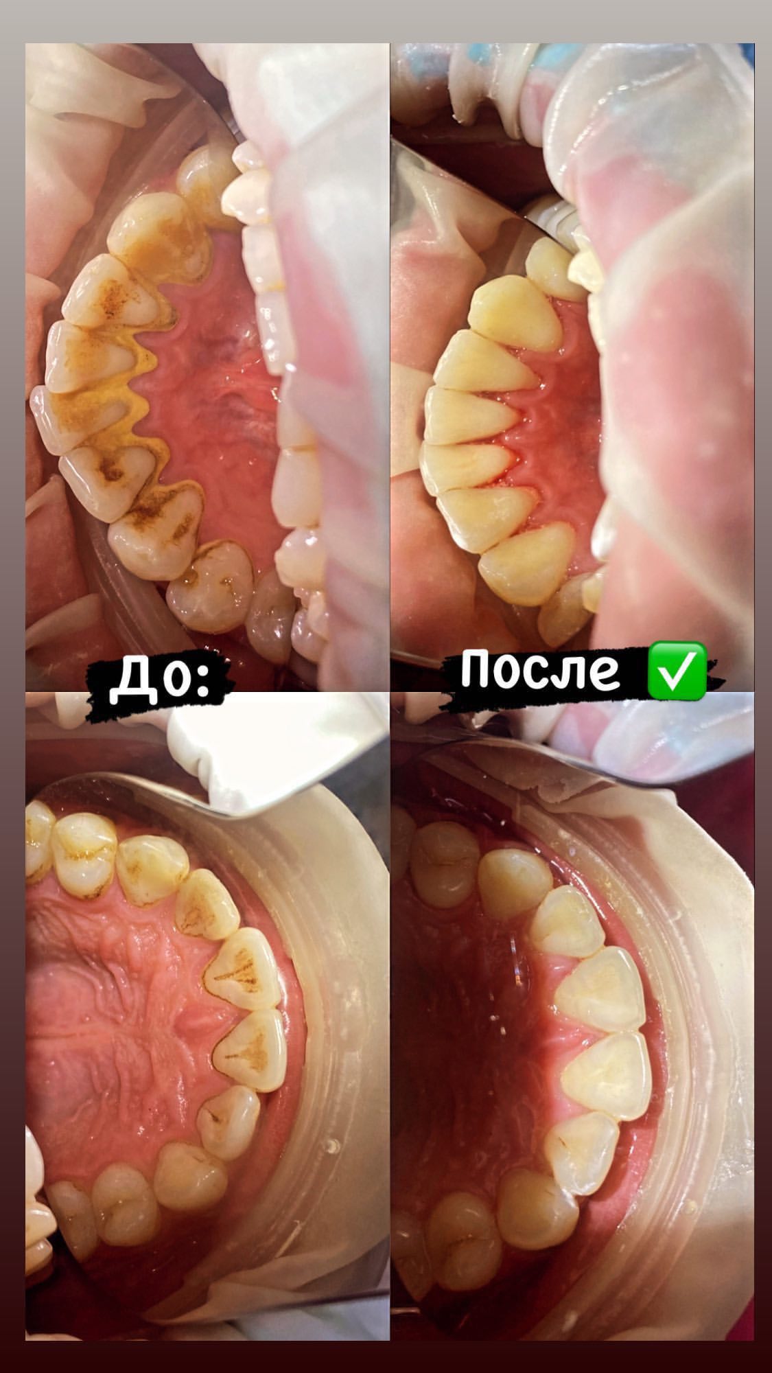 Работа Pro Stom